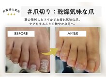 テネシー/＃爪切り：乾燥気味な爪 