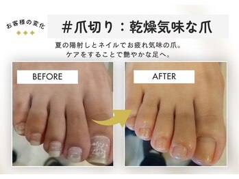 テネシー/#爪切り:乾燥気味な爪