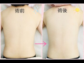 スマイルデイズ(Smiledays)/30代前半　ボディトリートメント