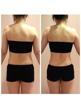 アヴィジョン(Avision)/