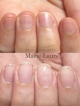 マリーロール 梅田店(Marie Laure)/自爪育成/深爪矯正/ネイルケア
