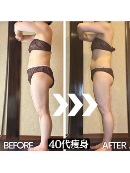 アーユルヴェーダアンドアロマエステ アユス(AYUS)/40代痩身