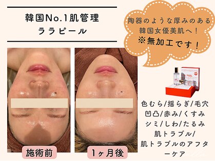ミーカラー(mecalla.)の写真