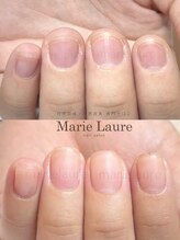 マリーロール 淀屋橋本店(Marie Laure)/自爪育成/深爪矯正/ネイルケア