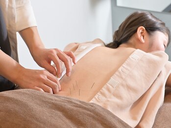 ハリスパ 堀江院/背中の鍼