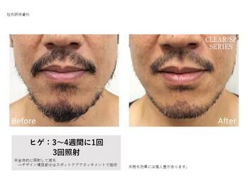 シズク ビューティーサロン(SHIZUKU beauty salon )/