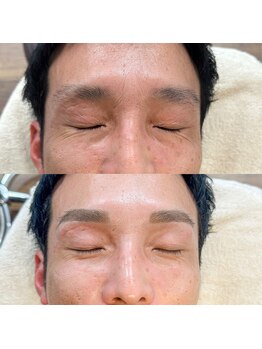 ベースバイループ(BASE BY LOOP)/薄い眉毛のコンプレックス解消