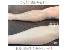 ラグズ(Ruxuce)の雰囲気(【脱毛/メンズ脱毛/メンズ眉毛/アイブロウ/眉毛サロン/多治見】)