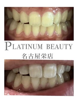 プラチナムビューティー 名古屋栄本店(PLATINUM BEAUTY)/お客様Before After