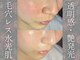 ブラックボックス(BLACK BOX)の写真