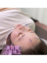 ヒューマン鍼灸接骨院/少ない本数で効果◎の美容鍼♪