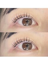 ネオン(Neon.)/お目元ぱっちり！