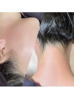 エファッセ 行田店(efface)の写真/完全都度払い◎メンズOK◎脱毛と一緒に毛穴の汚れにも◎ワントーン明るいと透明感×清潔感が叶う！