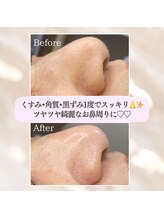 ビオエル(Bioell)/毛穴レス艶玉SKINララWax★