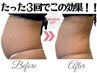 【何度でも◎】上半身徹底ダイエット★ハイパーナイフ&強力リンパ60分￥16000