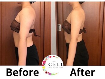 ヴァン ベール 那覇店/背中×二の腕ケア