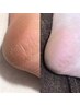 【角質ケア♪踵ツルツル魅せられる足へ☆】自宅では出来ない上質ケア◎