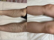 エステティック 華/