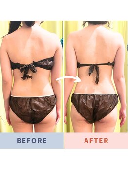 カルナ(CARNA)/最強トリプル痩身ケア