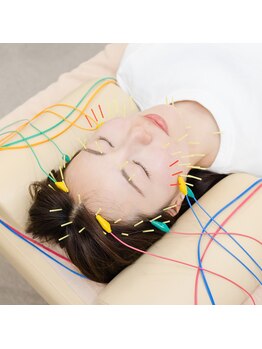 ピアーズ鍼灸整骨院の写真/加齢・お肌のコンディションが下がった、ニキビ・肌荒れにお悩みの方に！当店の美容鍼にお任せください★