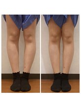 ととのえ美容整体