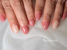 アマネラ(Amanera)/
