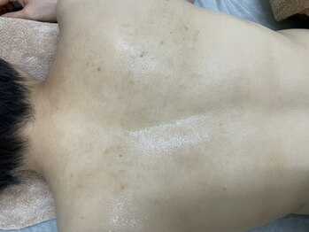 ナノハナ/鹿沼市の全身脱毛美容室ナノハナ