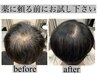 【育毛促進/抜け毛改善はこちら】　ヒト幹細胞育毛促進ヘッドスパ　¥22550→