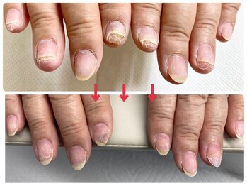 爪処 中野坂上/トラブル爪