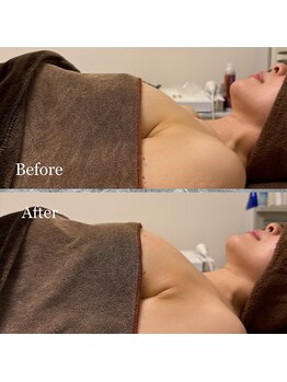 プリマベラ 大阪梅田(primabella)/バストの高さアップ！！