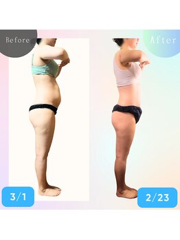 ナチュラルボディラボ 草津店/1年間before→after