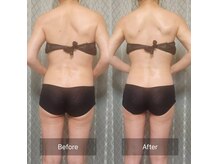 ローハ(ROHA)の雰囲気（マシン×バンブーボディコルギ×匠の手技で理想のボディラインへ）