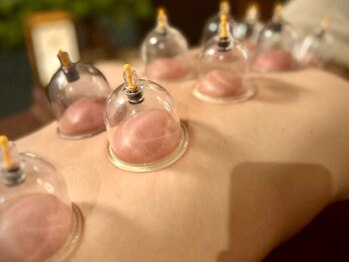 ザ ラウラ ビューティー ボディ(THE LAULA BEAUTY)の写真/希少な施術方法！カッピング&パワーツリーを軸にツボを外さないデトックスリンパマッサージ♪