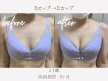 ハリスタ 三宮院(HARISTA)/3ヶ月間でAカップ→Dカップ