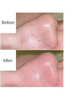 グラシア(gracia)/シミ・毛穴ケア専門店gracia