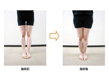 飯能ひだまり整骨院/骨盤矯正と美脚