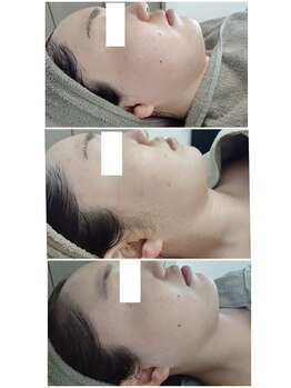 ビーユー(Be.you)/小顔