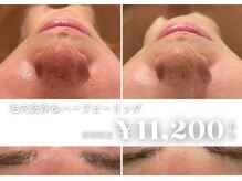 イデアルミー 大宮店(イデアルMe)の雰囲気（毛穴レス美肌・小顔・ハーブピーリングお任せください(^^)♪）