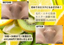 ミルトゥ(myrte)