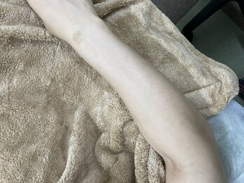 ナノハナ/鹿沼市の全身脱毛美容室ナノハナ