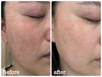 ストック(stock)/