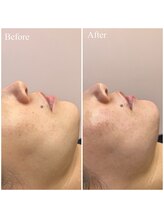 ホワイトワックス 京都四条烏丸(WHITE WAX)/《全顔》フェイシャルワックス