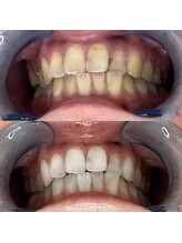 プロテア 藤枝店(PROTEA)/ブライダルメニューあり