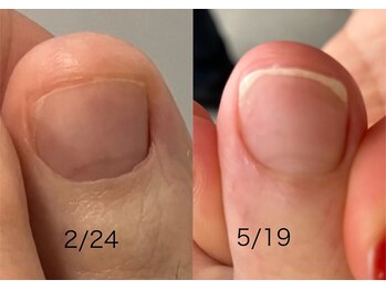 ロンディネ(Rondine)/フットケア31