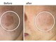 プラチナ ヒーリング(PLATINUM HEALING.)の写真