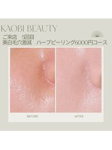 カオビビュティースパ(KAOBI Beauty Spa)/ハーブピーリング美白毛穴コース