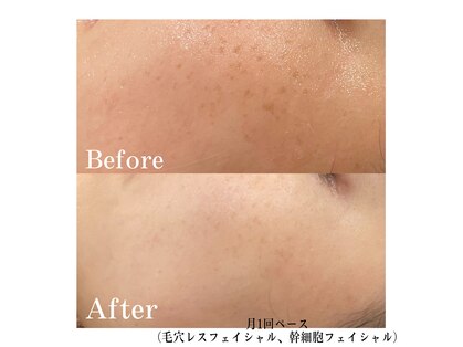 フォルチェ ゆめタウン広島店(Folche)の写真