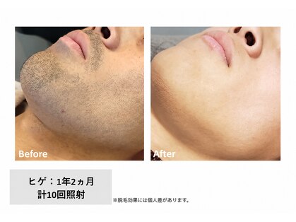 メン脱 三軒茶屋(Men脱)の写真