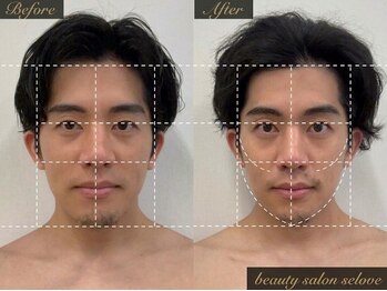「小顔に本気。」都度払い小顔専門店beauty salon seloveの写真/別府NEW OPEN★顔&頭皮のコリ・癒着を一瞬で解放!初回￥7800で目元・顎下スッキリ感動小顔!都度払い♪