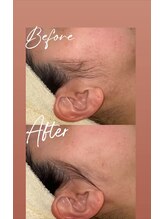 ピリナ(Pilina)/フェイスシェービング